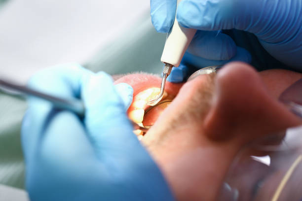 Best Urgent Tooth Repair  in Porter Heights, TX