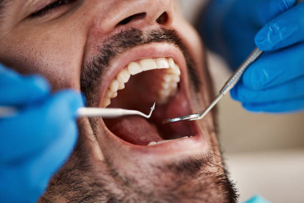 Best Knocked-Out Tooth Emergency  in Porter Heights, TX